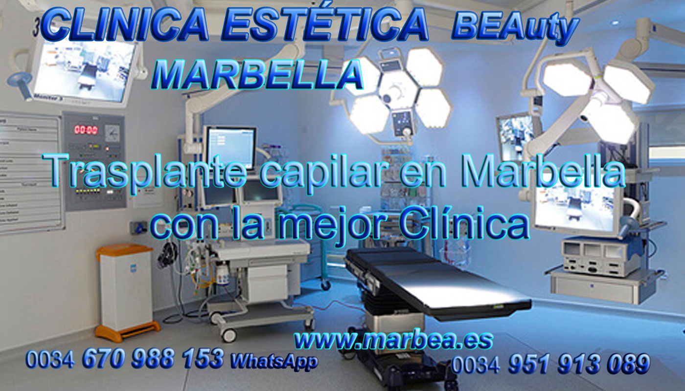 Trasplante pelo Clínica Estética y Implante Capilar Marbella y Málaga