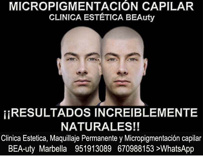 TRATAMIENTOS PARA LA ALOPECIA CLINICA ESTÉTICA dermopigmentacion capilar en Málaga o Marbella y MAQUILLAJE PERMANENTE en MARBELLA
