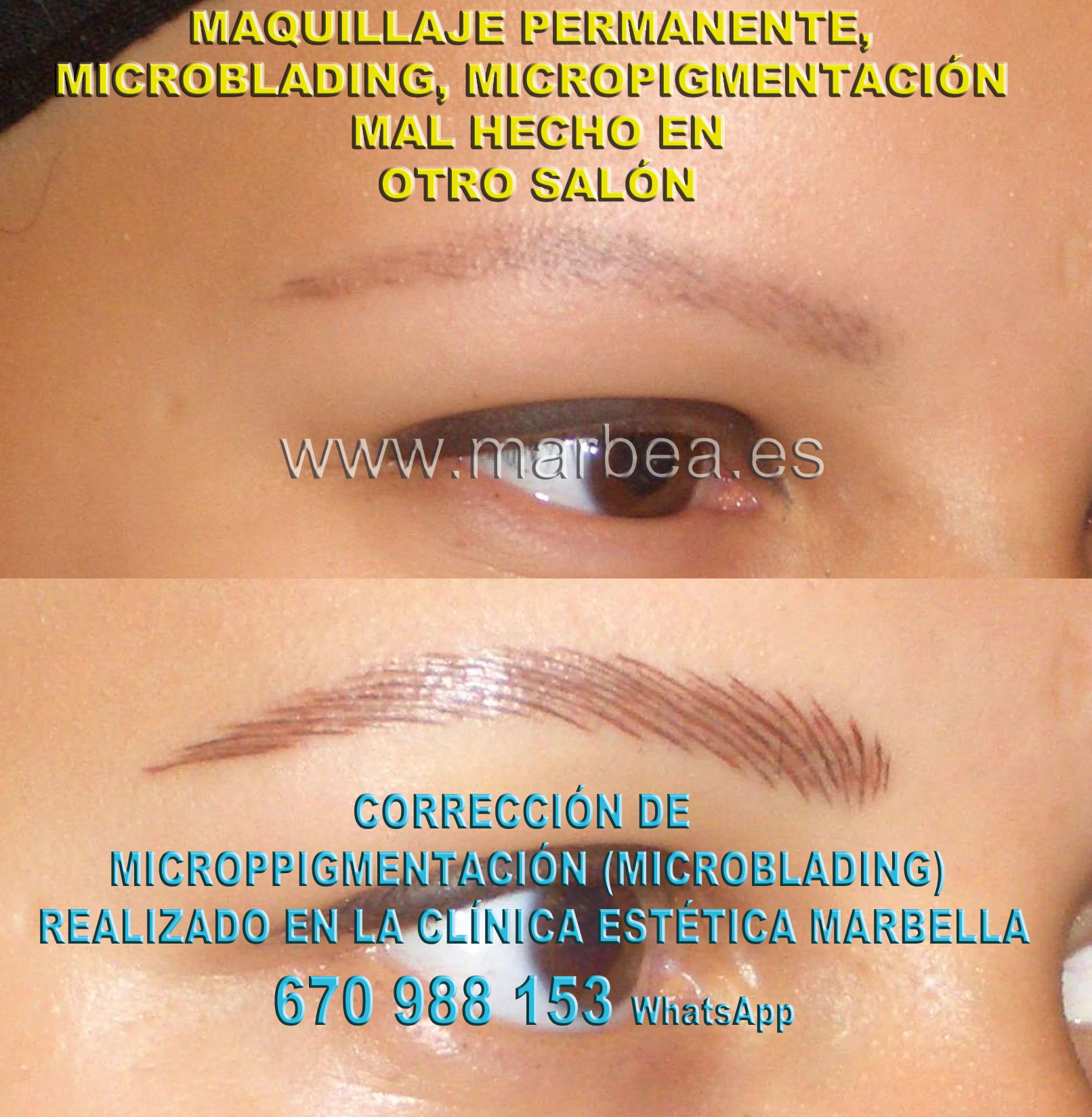 ELIMINAR TATUAJE CEJAS clínica estética maquillaje semipermanente propone eliminar la micropigmentación de cejas,micropigmentación correctiva cejas mal hecha