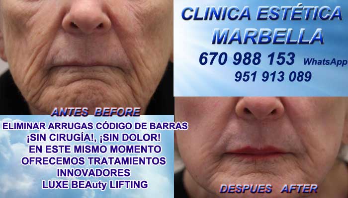  código de barras Puerto Banus:En la CLINICA ESTÉTICA MARBELLA te proponemos la mayor calidad de, nuestro servicio en Marbella or Puerto Banus