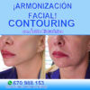 Clinica Estetica Marbella tratamiento con hilos tensores Marbella. Rejuvenecimiento Facial Marbella Lifting Sin Cirugía Marbella.