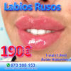 Aumento de labios en Marbella, acido hialuronico para los labios en marbella. Relleno de labios en marbella volumen labios marbella