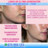 Rejuvenecimiento Facial Marbella con peeling Marbella. tratamientos contra el acné en Marbella