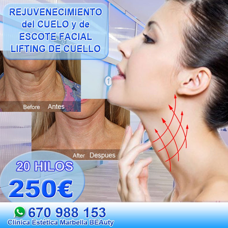 Clinica Estética Marbella, rejuvenecimiento facial sin cirugía reducción arrugas Marbella, relleno arrugas Marbella  belleza Marbella. Corrección las arrugas Marbella, eliminacion arrugas Marbella arrugas borrar Marbella. Tratamiento de arrugas Marbella, Marbella - corrección las arrugas. Liposucción sin cirugía Marbella, blefaroplastia Marbella. Aumento labios Marbella, relleno facial Marbell Eliminación ojeras Marbella. Tratamiento celulitis marbella, rejuvenecimiento facial Marbella. Estrías Marbella, rejuvenecimiento Marbella. hilos-cuello DESCUBRE NUESTRAS OFERTAS Y PROMOCIONES