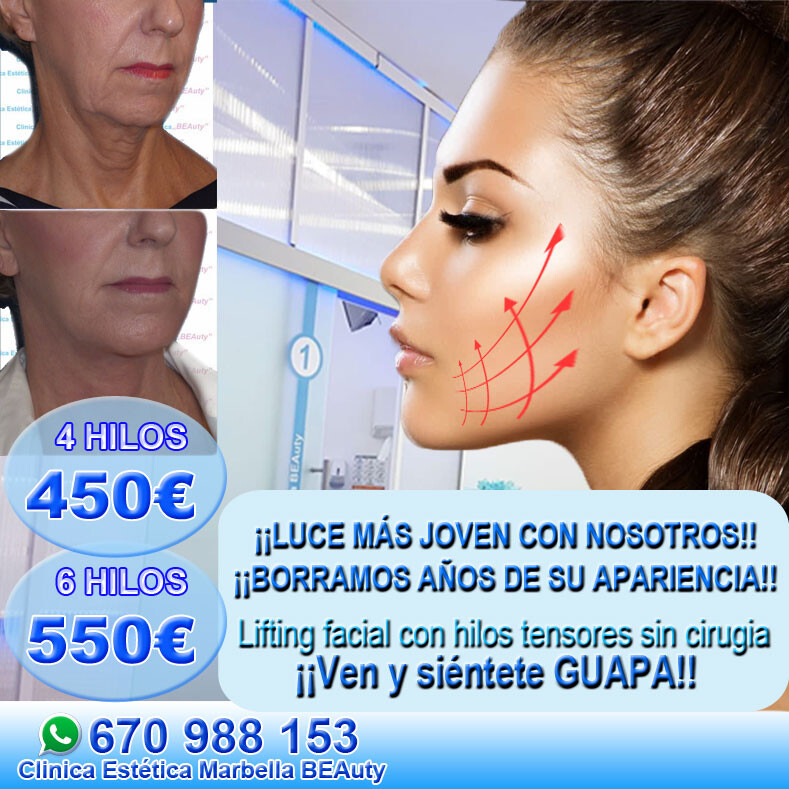 Clinica Estética Marbella, rejuvenecimiento facial sin cirugía reducción arrugas Marbella, relleno arrugas Marbella  belleza Marbella. Corrección las arrugas Marbella, eliminacion arrugas Marbella arrugas borrar Marbella. Tratamiento de arrugas Marbella, Marbella - corrección las arrugas. Liposucción sin cirugía Marbella, blefaroplastia Marbella. Aumento labios Marbella, relleno facial Marbell Eliminación ojeras Marbella. Tratamiento celulitis marbella, rejuvenecimiento facial Marbella. Estrías Marbella, rejuvenecimiento Marbella. HILOS-TENSORES-450-550 OFERTAS ESTÉTICA MARBELLA