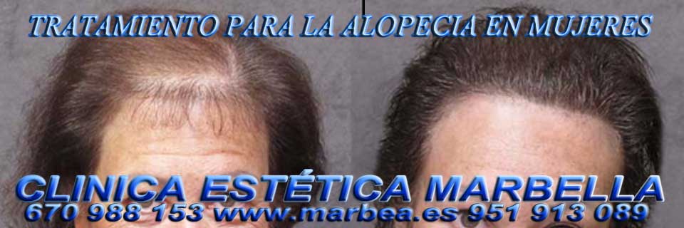 estrías blancas Marbella CLINICA ESTÉTICA en MARBELLA ofrece lifting sin cirugia Marbella