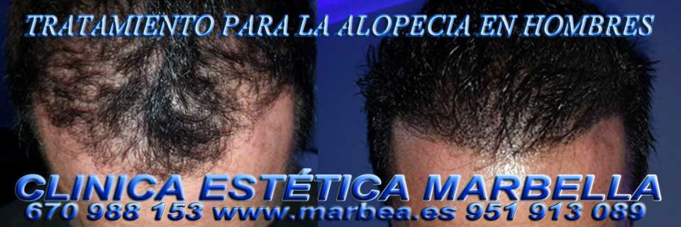Celulitis Marbella CLINICA ESTÉTICA en MARBELLA ofrece blefaroplastia Marbella