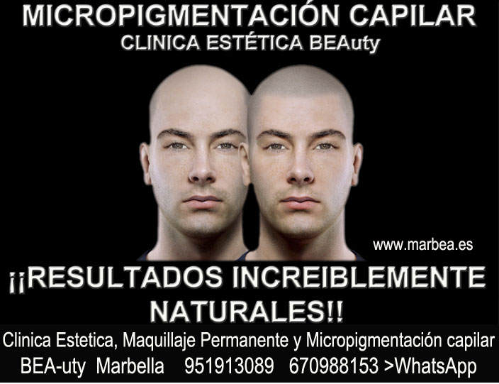 clinica estética, micropigmentación capilar Málaga or Marbella y maquillaje permanente en marbella ofrece: dermopigmentacion capilar , tatuaje capilar