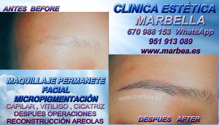  CLINICA ESTÉTICA entrega Micropigmentación labios en Marbella y en Málaga