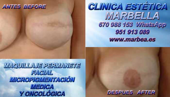 CICATRICES PECHOS clínica estética maquillaje permanete entrega camuflaje cicatrices posteriormente de reduccion de mamaria