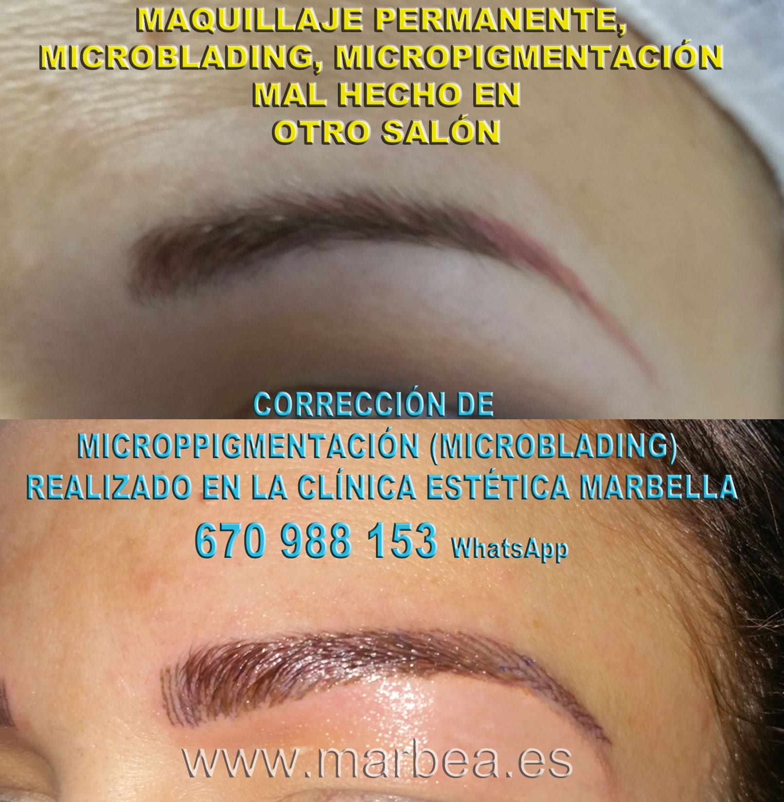 Borrar microblading mal hecha clínica estética tatuaje propone micropigmentacion correctiva de cejas,reparamos microppigmentacion mal hechos