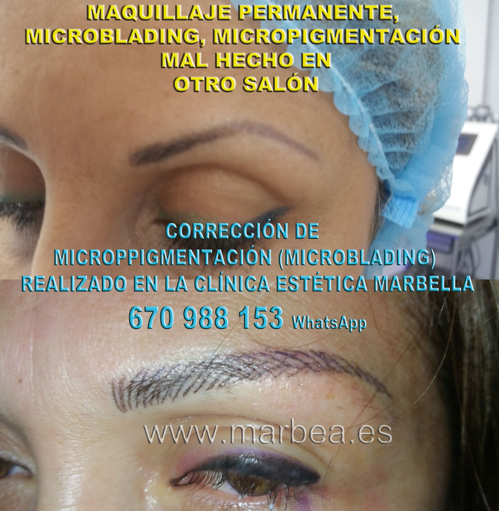 corrección de microblading en cejas clínica estética tatuaje entrega corrección de micropigmentación en cejas,corregir micropigmentación mal hecha